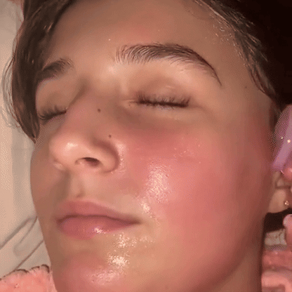 SkinSculpt Facial Cupping