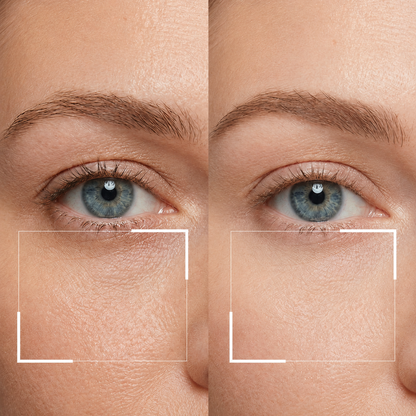 Instant Firm Collagen Eye Lift Patches