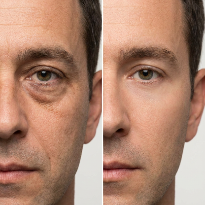 Instant Firm Collagen Eye Lift Patches